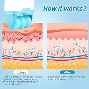 Face Tighten Roller